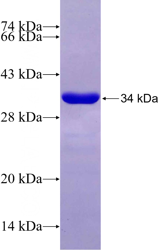 Recombinant Human CEP135 SDS-PAGE
