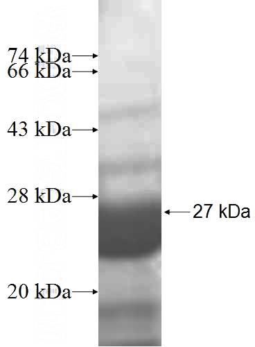 Recombinant Human MCTS1 SDS-PAGE