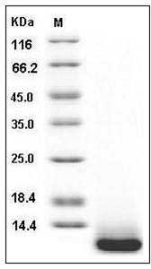 Human SPINK4 Protein (His Tag) SDS-PAGE