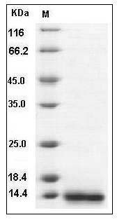 Human MCP-3 / CCL7 Protein (His Tag) SDS-PAGE
