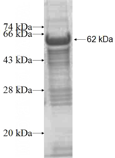 Recombinant Human RPS6KB2 SDS-PAGE