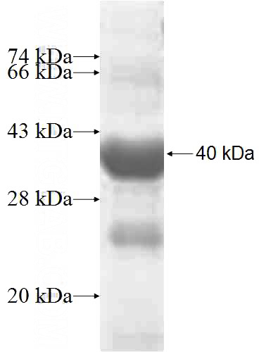 Recombinant Human TRADD SDS-PAGE
