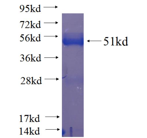 Recombinant human C9orf9 SDS-PAGE