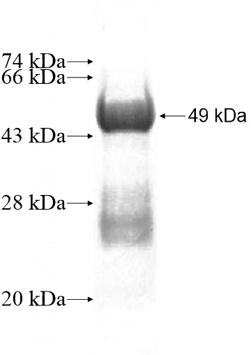 Recombinant Human MED20 SDS-PAGE