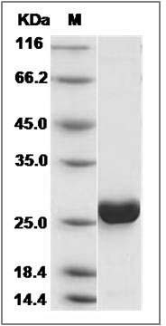 Human CMPK1 Protein (His Tag) SDS-PAGE