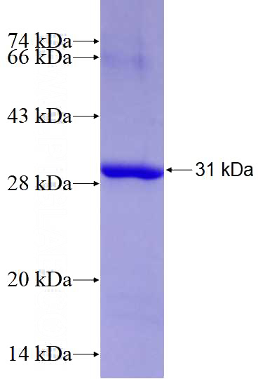 Recombinant Human EIF2B3 SDS-PAGE