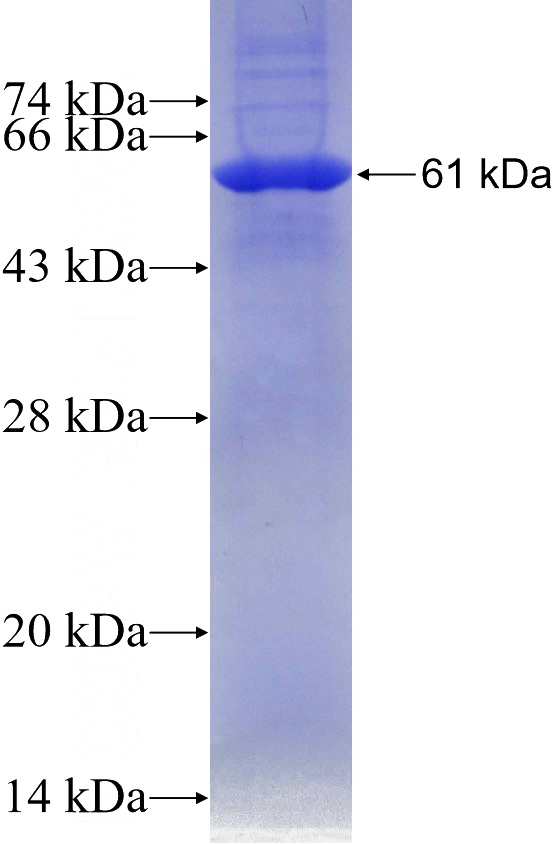 Recombinant Human FBXW11 SDS-PAGE