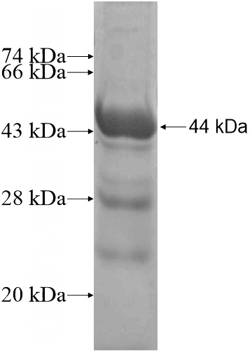 Recombinant Human CDC7 SDS-PAGE