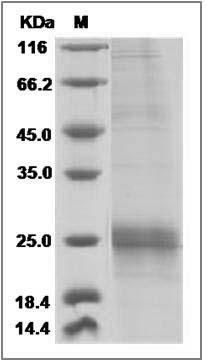 Human SLC27A4 / FATP4 Protein (His Tag) SDS-PAGE