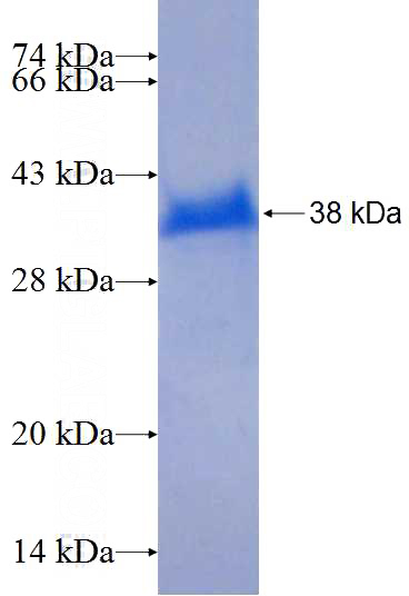 Recombinant Human HYAL2 SDS-PAGE