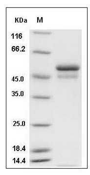 Mouse SerpinI1 / Neuroserpin Protein (His Tag) SDS-PAGE