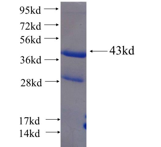 Recombinant human THRSP SDS-PAGE