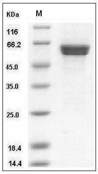 Human CAMK1D / CKLiK Protein (GST Tag) SDS-PAGE
