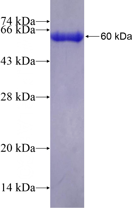 Recombinant Human PRPF4 SDS-PAGE