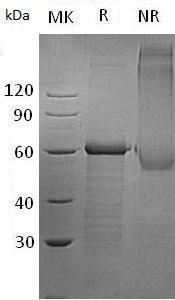 Human UBAP1/NAG20 (His tag) recombinant protein