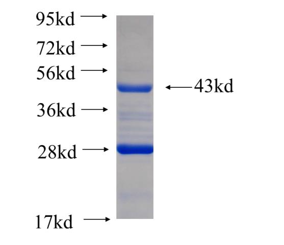 Recombinant human ARPC5L(Full length) SDS-PAGE