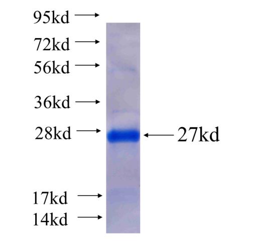 Recombinant human HESX1(Full length) SDS-PAGE