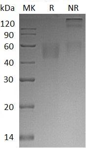 Human NECTIN3/PRR3/PVRL3 (His tag) recombinant protein