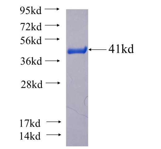 Recombinant human NKX3-2 SDS-PAGE