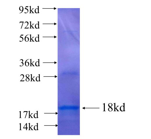 Recombinant human IMMP2L(Full length) SDS-PAGE