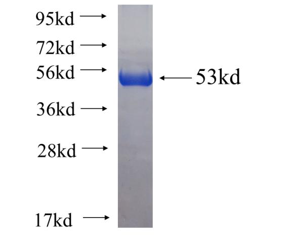 Recombinant human HSCB(Full length) SDS-PAGE