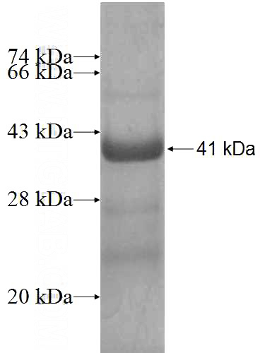 Recombinant Human HYAL3 SDS-PAGE