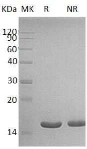 Human ACOT13/THEM2/HT012/PNAS-27 (His tag) recombinant protein