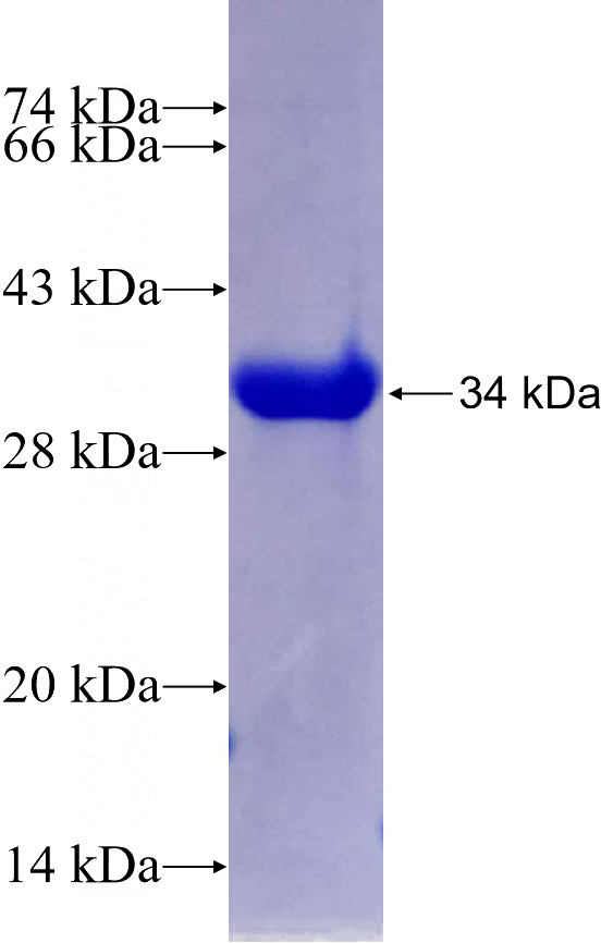 Recombinant Human NFE2L3 SDS-PAGE