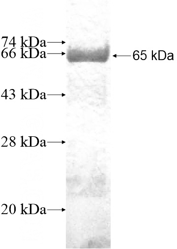 Recombinant Human FAM118B SDS-PAGE