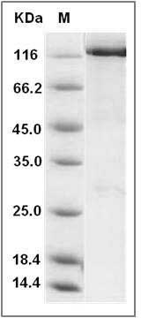 Human WWP2 Protein (His & GST Tag) SDS-PAGE
