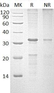 Human CASP10/MCH4 (His tag) recombinant protein