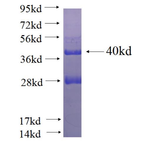 Recombinant human CDC23 SDS-PAGE