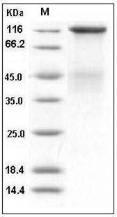 Human Insulin Receptor / INSR / CD220 Protein (long isoform, His Tag) SDS-PAGE