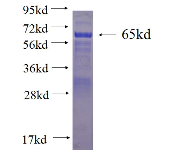 Recombinant human TMPRSS4 SDS-PAGE