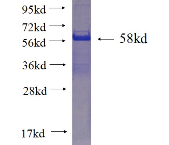 Recombinant human FHL1 SDS-PAGE