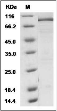 Human KDM1 / LSD1 Protein (His & GST Tag) SDS-PAGE