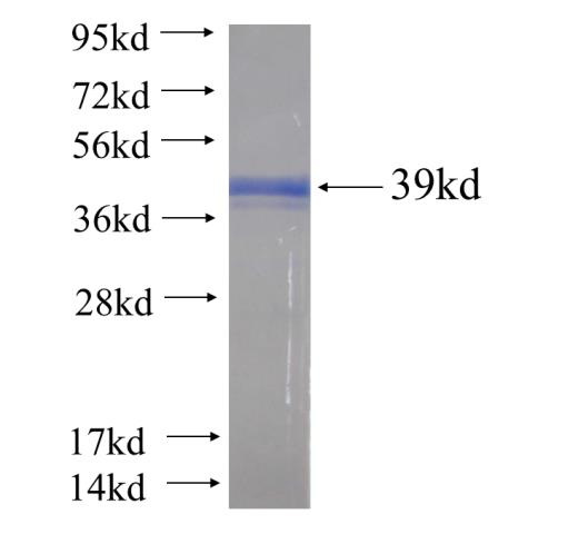 Recombinant human FAM84B(Full length) SDS-PAGE