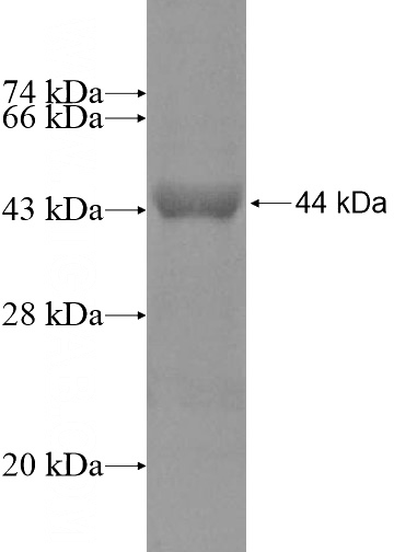 Recombinant Human PLD1 SDS-PAGE