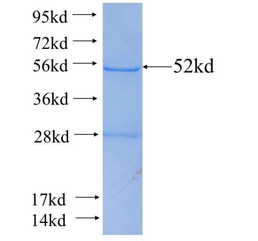 Recombinant human LYPLAL1(Full length) SDS-PAGE