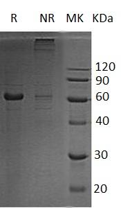 Human IRF5 (His tag) recombinant protein