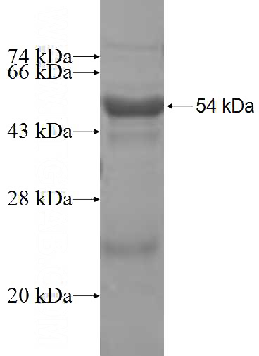 Recombinant Human MED6 SDS-PAGE