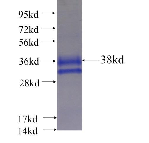 Recombinant human FOXP1 SDS-PAGE