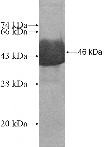 Recombinant Human ALDH18A1 SDS-PAGE