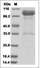 Human ANTXR2 / CMG2 Protein (Fc Tag) SDS-PAGE