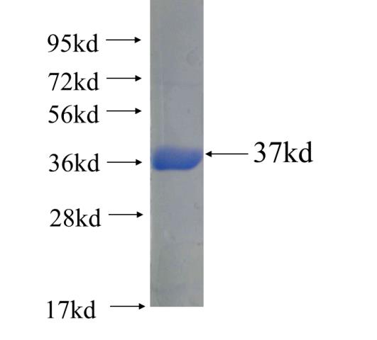 Recombinant human GCLM(Full length) SDS-PAGE