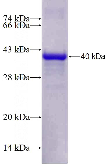 Recombinant Human LDLRAP1 SDS-PAGE