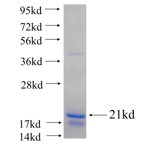 Recombinant human ERC1 SDS-PAGE