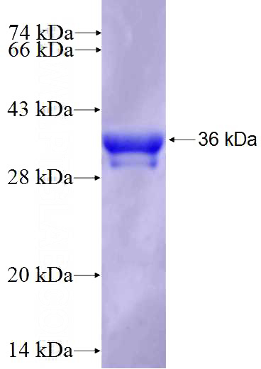 Recombinant Human FOXP3 SDS-PAGE