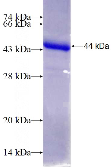 Recombinant Human ABCG1 SDS-PAGE