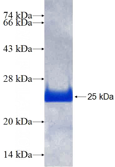 Recombinant Human CBX3 SDS-PAGE